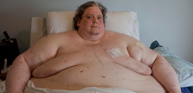 Morto Keith Martin, l‘uomo più grasso: 44 anni, 450 chili