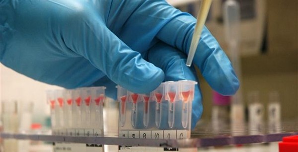 Virus zika, Oms: almeno un anno e mezzo per test su vaccini (video)