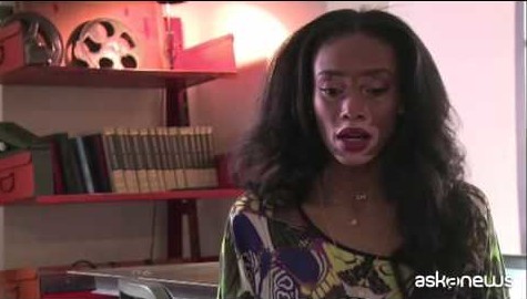 Chantelle, modella con la vitiligine conquista il fashion system (VIDEO)