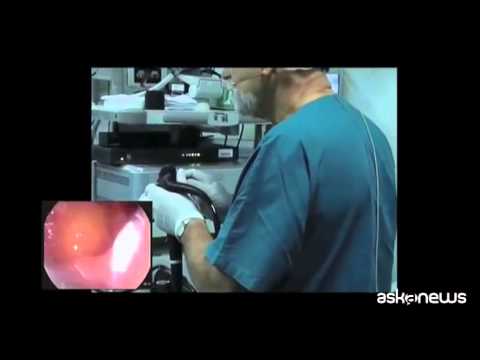 Startup italiana che scopre rischio tumore in 15 secondi