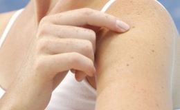 Tumore-della-pelle-non-melanoma