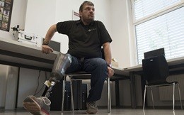 feeling-leg2_3333404b