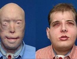 20151117_video_10374896_large