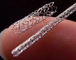 stents