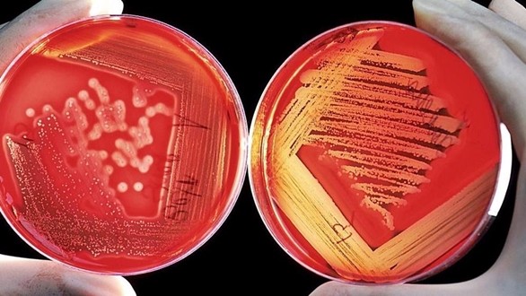 batterio_eschirichia ricerca laboratorio3