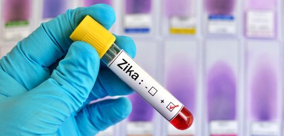 Zika-Virus