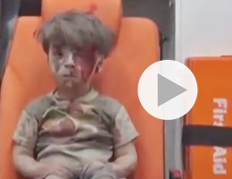 Guerra in Siria, l’orrore della guerra nello stupore attonito di un bimbo ferito