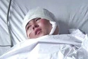 Afghanistan, 23enne mutilata dal marito che le taglia le orecchie