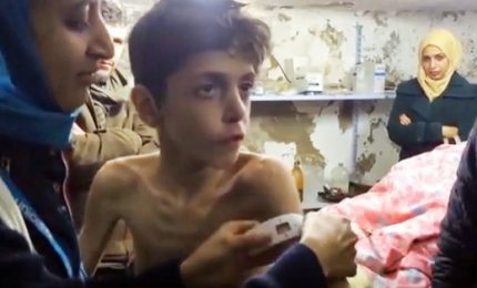Strage in Siria, Medici Senza Frontiere tra le corsie degli ospedali: vittime esposte ai gas