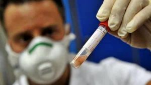 meningitericercalaboratorio