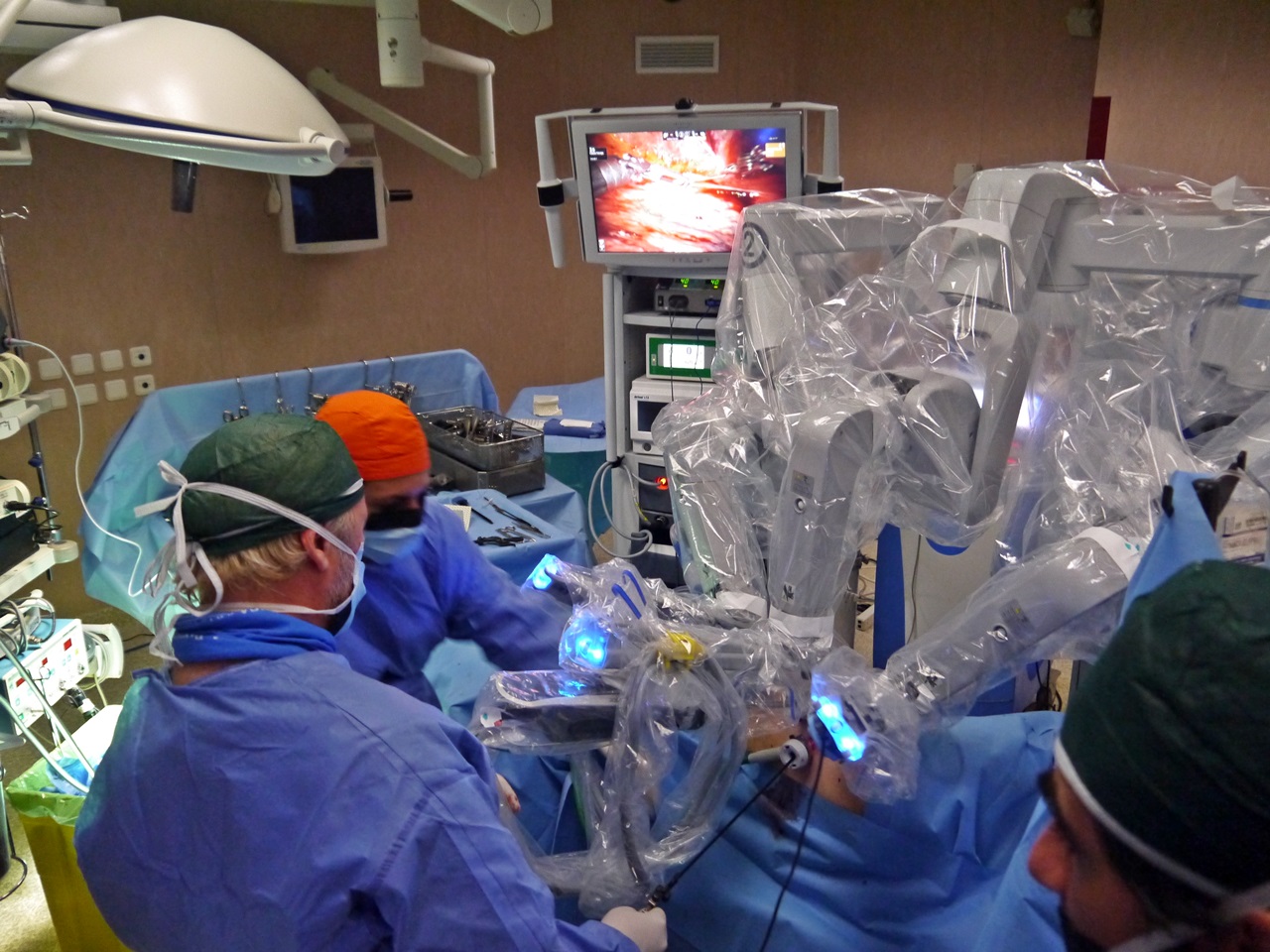 Chirurgia del pancreas, nuova tecnica “made in Pisa”