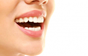 sorriso-removebg-preview