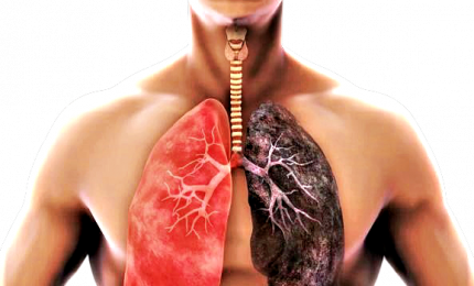 Fumo e tumore al polmone, rischio malattia non è uguale per tutti