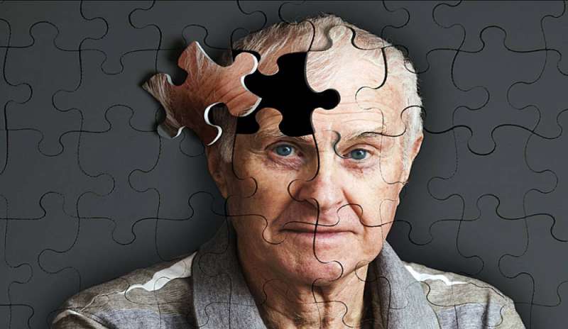 Alzheimer, italiani scoprono molecola che “ringiovanisce” cervello