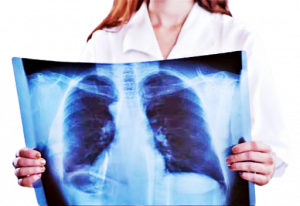 polmoniradiografia-removebg-preview