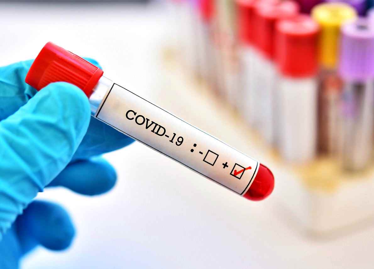 Coronavirus, ondata di ritorno possibile. Parla l’esperto