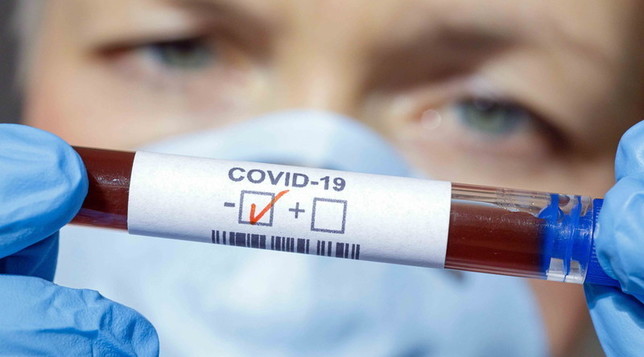 Coronavirus, meno contagi ma più morti. La Sicilia fa registrare 15 nuovi casi