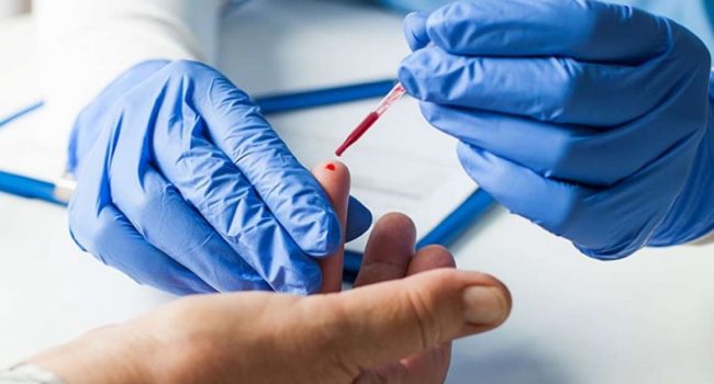 Coronavirus, medici di base prescriveranno i test