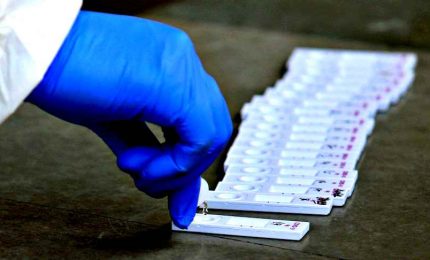 L'allarme dei biologi: test veloci in farmacia inaffidabili
