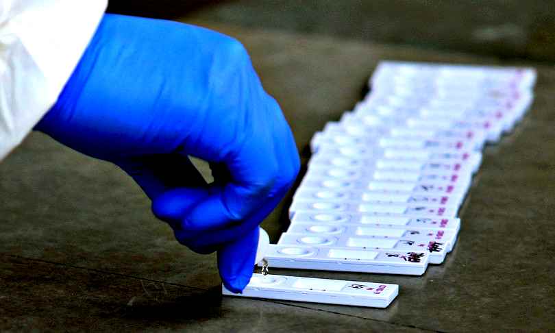L’allarme dei biologi: test veloci in farmacia inaffidabili