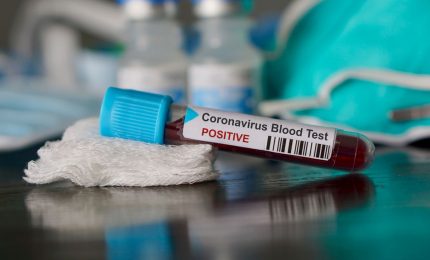 Coronavirus, i nuovi contagiati non si fermano. Arcuri: ospedali troppo affollati, più test e cure a casa