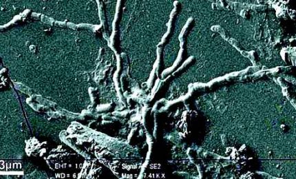 Eruzione di Ercolano, scoperti neuroni in un cervello vetrificato