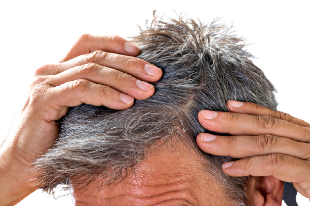 caduta-capelli-curarla-farmaci-bisturi-removebg-preview