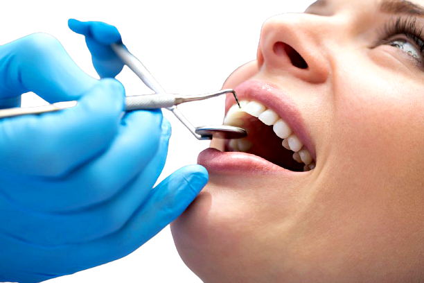 malattia-parodontale-prevenire-1024x682-removebg-preview