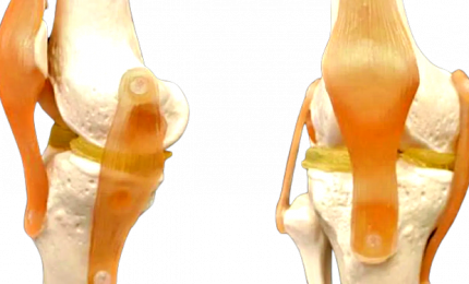 Idrogel per ripristinare cartilagine ginocchio danneggiata