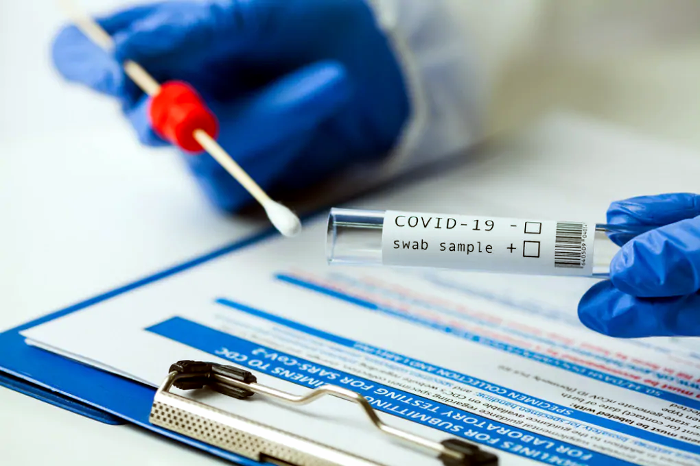 Covid-19, Iss: tra over 80 no vax tasso decesso 45 volte più alto