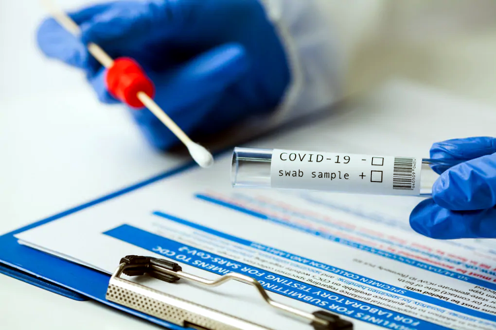 Covid-19: in Francia esplode variante Beta, potrebbe eludere i vaccini