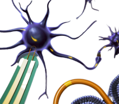 Nanosonde intercettano precocemente tumori a Alzheimer