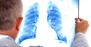 Il-virus-respiratorio-sinciziale-removebg-preview