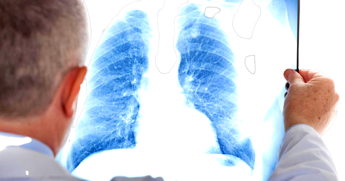 Il-virus-respiratorio-sinciziale-removebg-preview