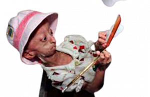 malattie_rare-removebg-preview