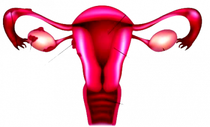 Endometriosi e alimentazione, privilegiare cibi antifiammatori