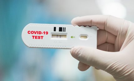 Coronavirus, nuovi contagi in picchiata ma con pochi tamponi processati nel weekend