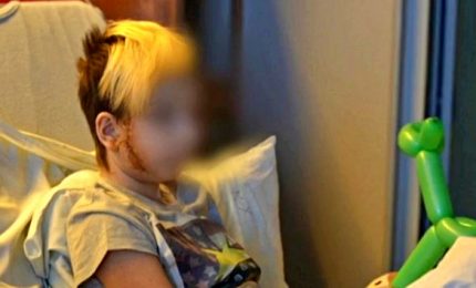 Nell'ospedale pediatrico di Kiev fra i bambini feriti di guerra