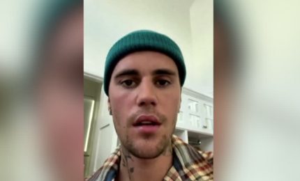Justin Bieber ai fan: ho una paresi facciale a causa di un virus