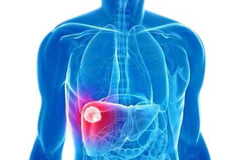 Epatite C, ancora poca conoscenza e un grande sommerso