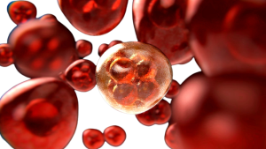 test-per-riconoscere-il-tumore-removebg-preview