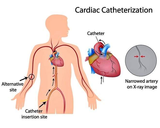 Anomalie del cuore, diagnosi più sicure senza raggi X