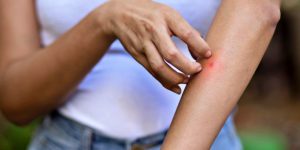 rimedi-naturali-zanzara-1042x490 (1)