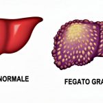Dalla disbiosi intestinale al fegato grasso, il ruolo chiave della fatica cronica al risveglio