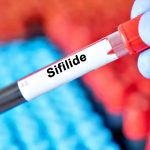 sifilide