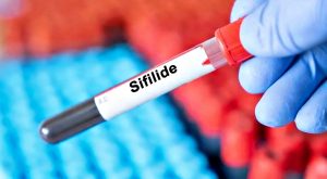 sifilide